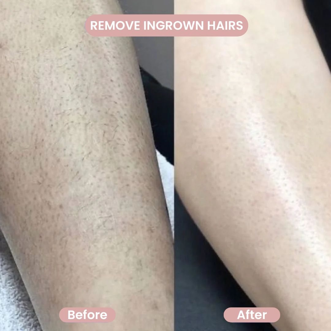 VersaShave Pro